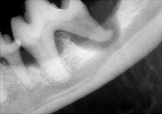 Abnormal dental radiograph