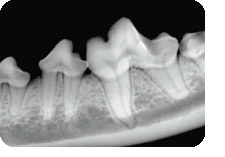 Normal dental radiograph