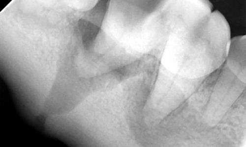 Teeth x-ray image